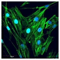 Confocal image of double stained fibroblasts